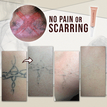 Load image into Gallery viewer, BOROLINE Tattoo Removal Cream