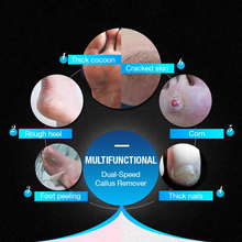 Load image into Gallery viewer, (Deal of the day!!! )USB Rechargeable Vacuum Adsorption Foot Grinder