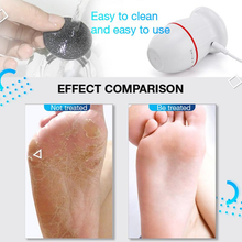 Load image into Gallery viewer, (Deal of the day!!! )USB Rechargeable Vacuum Adsorption Foot Grinder 230602
