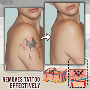 BOROLINE Tattoo Removal Cream