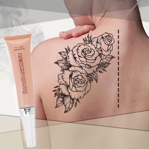 BOROLINE Tattoo Removal Cream