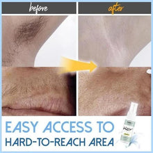 Load image into Gallery viewer, SEMI-PERMANENT HAIR REMOVAL SPRAY
